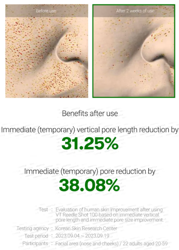 VT - Reedle Shot 100 - (50 ml) - Image 3